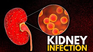 Kidney Infection, Causes, Signs and Symptoms, Diagnosis and Treatment.