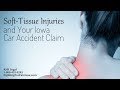 Soft-Tissue Injuries and Your Iowa Car Accident Claim