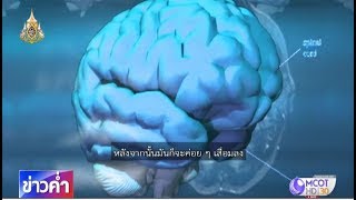 ชัวร์ก่อนแชร์ : 10 วิธีดูแลสมองให้เฉียบคม จริงหรือ ?