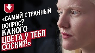 Альбинос: Катя | Быть молодым