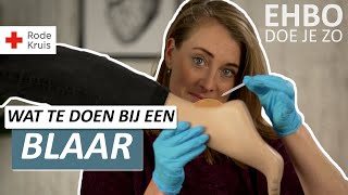 Met vuur de naald ontsmetten?! | Hoe behandel je blaren? | Rode Kruis EHBO