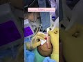 LIVE - Slit Making process during Hair Transplant Surgery by Dr. Gaurang Krishna, MD #shorts