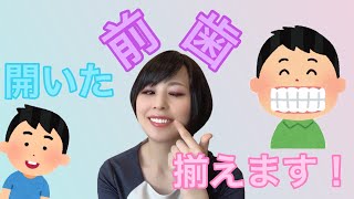 出っ歯も変色もお任せあれ！ホワイトニングもセラミックも一緒で綺麗な歯並びへ