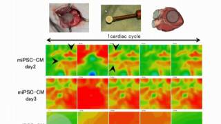 [再生医療]平成26年度公開シンポジウム　講演３　澤芳樹「iPS細胞を用いた心筋再生治療創成拠点」