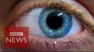 Stem cell cure for blindness tested - BBC News