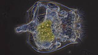 Different microscope objectives and their effects