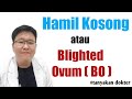 HAMIL KOSONG atau BLIGHTED OVUM (BO) - TANYAKAN DOKTER - dr.Jeffry Kristiawan