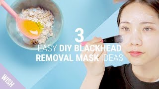 3 Home Remedies For Different Types of Blackhead Concerns | DIY Blackhead Remover Mask