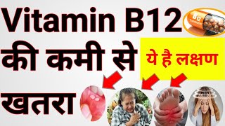#vitamin b12 deficiency symptoms hindi#weakness#pharmacy Time channel#video
