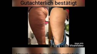 ByeBye Cellulite wirkt! Gutachterlich bestätigt. Topseller by Dr.Juchheim Cosmetics.