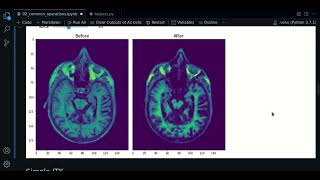 2.0 - Denoise & morphological operations | ANTsPy - Course MRI preprocessing with Python