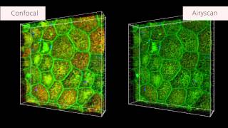 ZEISS LSM 880 with Airyscan: Human intestinal stem cells