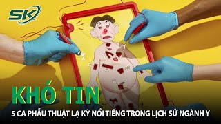 KHÓ TIN: 5 Ca Phẫu Thuật Lạ Kỳ Nổi Tiếng Trong Lịch Sử Ngành Y | SKĐS