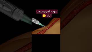 سحب الدم من الوريد #تمريض