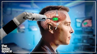 Neuralink Preparing For Human Trials In 2022!