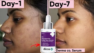 7-day Derma Co Serum Challenge: You won't believe what happened 😱