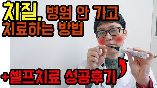 치질약 총 정리 + 정약사의 치질 셀프치료 후기 공유합니다.