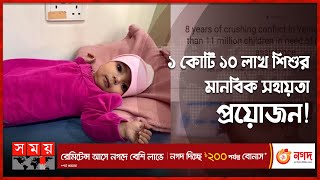 প্রতি ১০ মিনিটে ইয়েমেনে মা-রা যাচ্ছে ১টি শিশু ! | Yemen Child | Malnutrition | Yemen News | Somoy TV