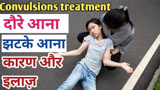 दौरे आना,झटके आना/convulsions treatment || causes, symptoms || medicines || #medishanmedicos