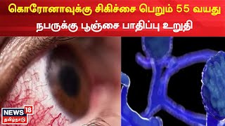 Fungus Infection Symptoms | உத்தர பிரதேசத்தில் கருப்பு, வெள்ளை பூஞ்சை பாதிப்பு கண்டுபிடிப்பு | UP