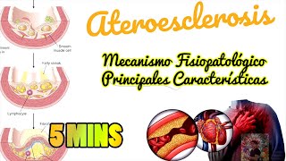 ATEROESCLEROSIS FISIOPATOLOGÍA en 5 MINS by Oliver