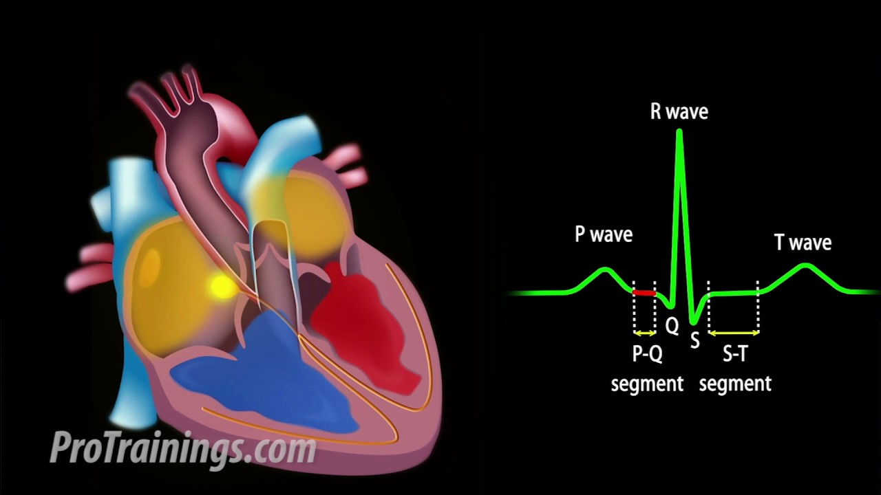 ECG Interpretation (aka EKG Interpretation) - YouTube