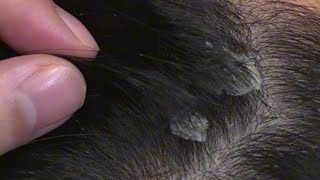ASMR-Super comfortable scalp care