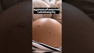 ഒമ്പതാം മാസത്തിൽ ഗർഭിണികൾക്ക് ഉണ്ടാകുന്ന ശാരീരിക മാറ്റങ്ങൾ  #pregnancy #viralvideo #baby #newborn