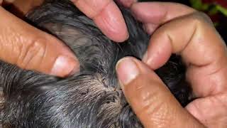 #nitsremoval  wife removed husband lices super video || long hair lice remove//short video 💯part14😑