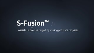 Urology with RS85 Prestige