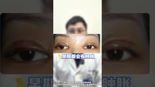 双眼皮手术后睁眼累是手术失败了吗？ 硬核健康科普行动 医学科普 双眼皮 眼袋 眼周抗衰