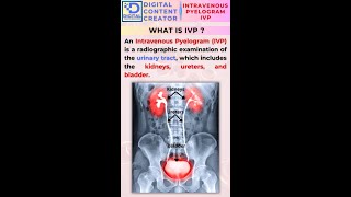 Intravenous Pyeolgram || Understanding Intravenous Pyelogram (IVP) - Procedure and Preparation.