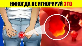 8 КРИТИЧЕСКИХ СИМПТОМОВ РАКА ТОЛСТОЙ КИШКИ, КОТОРЫЕ НИКОГДА НЕ СЛЕДУЕТ ИГНОРИРОВАТЬ