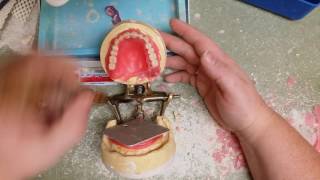 11min Denture Set-up