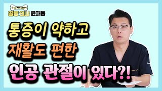 인공 관절 수술 미루고 있다면 이 영상 확인하세요 - 골통 의사 윤재웅 #05