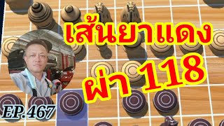 หมากรุกไทย เส้นยาแดงผ่า 118 EP.467