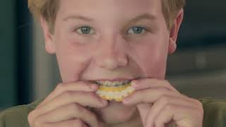 Braces - Part One: Instructions & Tips