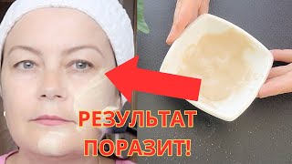 СМЕШАЙТЕ ДРОЖЖИ и ФАРФОРОВАЯ КОЖА  будет даже в 70 лет! Результат ПОРАЗИТ ВАС!