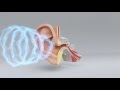 Explore the Science of Hearing Loss | Miracle-Ear Hearing Center