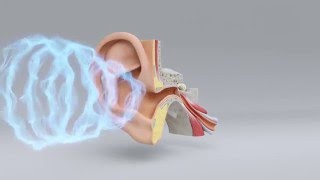Explore the Science of Hearing Loss | Miracle-Ear Hearing Center