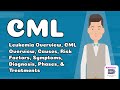 Chronic Myeloid Leukemia (CML) Overview, Causes, Risks, Symptoms, Diagnosis, Phases, & Treatments