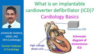 What is an implantable cardioverter defibrillator (ICD)? Cardiology Basics