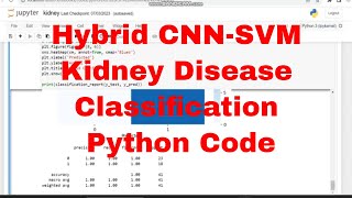 Kidney Disease Classification Hybrid CNN-SVM from Scratch Python Code / Hybrid CNN-SVM Python Code
