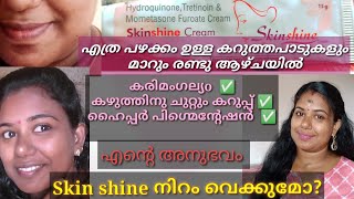 ✅️ Effective solution for Hyper pigmentation / skin shine honest review/ 2022  #face#neck