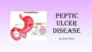 Peptic ulcer disease - gastric vs duodenal, symptoms, investigations, treatment, dumping syndrome