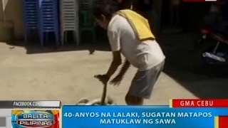 40-anyos na lalaki, sugatan matapos matuklaw ng sawa