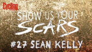 Show us your scars: Sean Kelly | Cycling Weekly