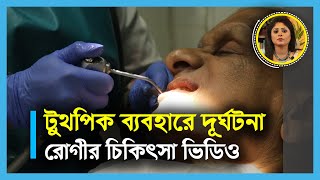 টুথপিক ব্যবহার বন্ধ করুন।Stop using toothpick