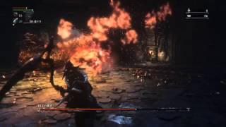 [Bloodborne]冒涜！旧主の番犬　Lv30解説付き