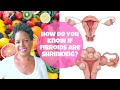 HOW DO YOU KNOW IF FIBROIDS ARE SHRINKING?  | By: What Chelsea Eats